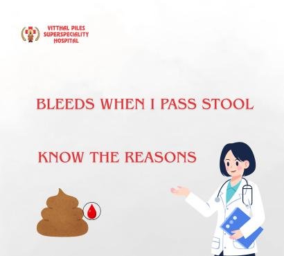 Bleeding While Passing Stool – Should You Worry?
