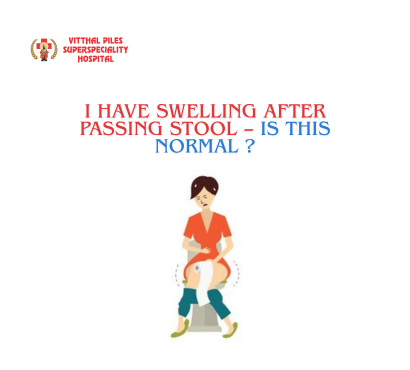 Swelling-After-Passing-Stool